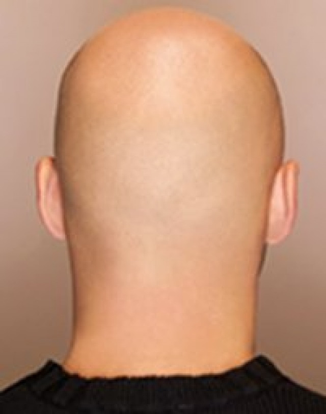 Maarco